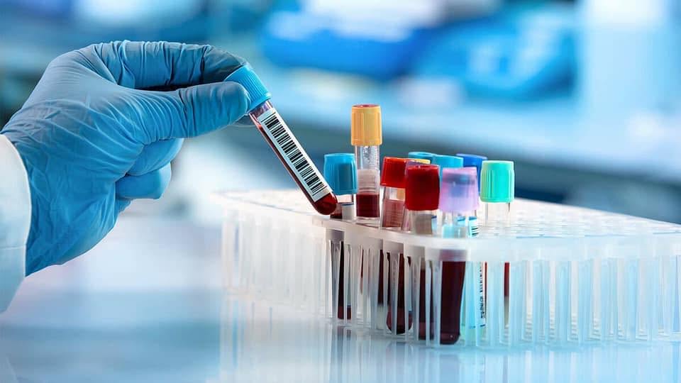 Xét nghiệm máu có phát hiện bệnh ung thư hay không?
